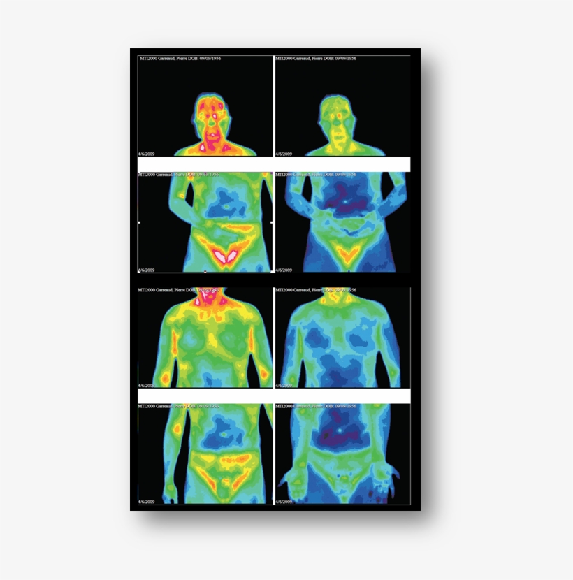 Before And After Taking Double Helix Water - Human Body Temperature, transparent png #1882516