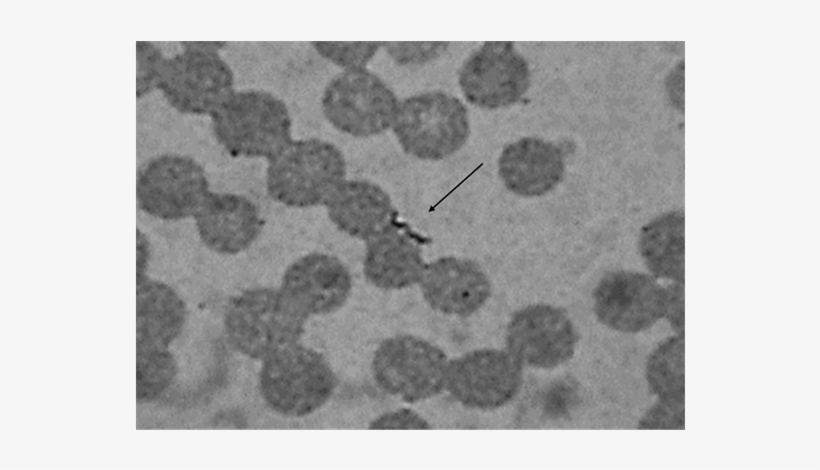 Leptospira In Blood - Leptospira Blood, transparent png #1928153