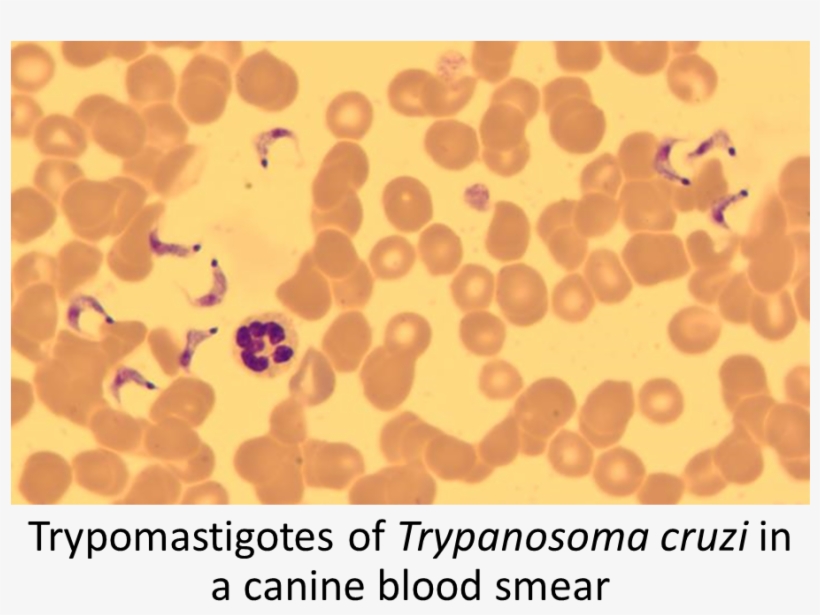 Trypanosoma Cruzi Method Of Diagnosis Find Amastigotes - Trypanosoma Cruzi, transparent png #1928249