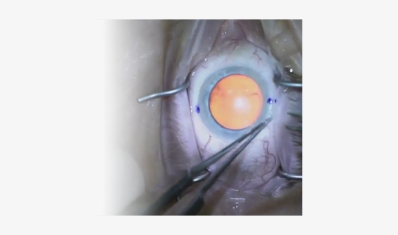 Visioncare Sumit Garg, Md - Painting, transparent png #1939936