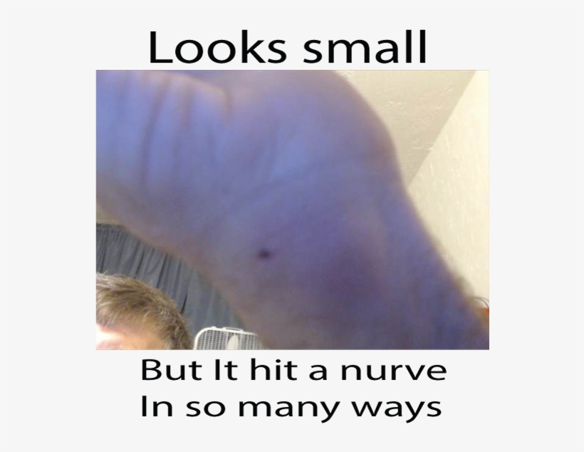 Ouch - Netgear Router Reset Button, transparent png #1969696