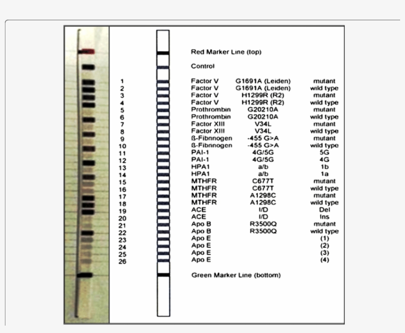 Design Of Cvd Strip Assay Test Used In The Current - Cvd Strip Assay, transparent png #2024435