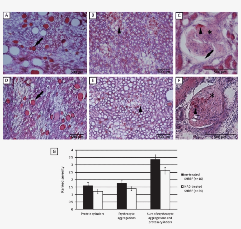 Kidney Pathology In No-treated Shrsp And In Shrsp Under - Secretion, transparent png #2028466