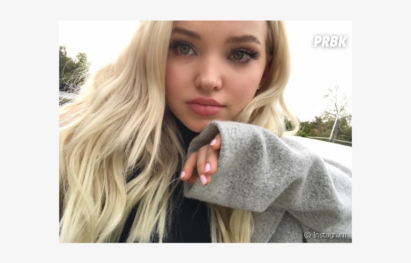 Dove Cameron De "descendentes" Conta Que Gostaria De - Dove Cameron With Freckles, transparent png #2035900
