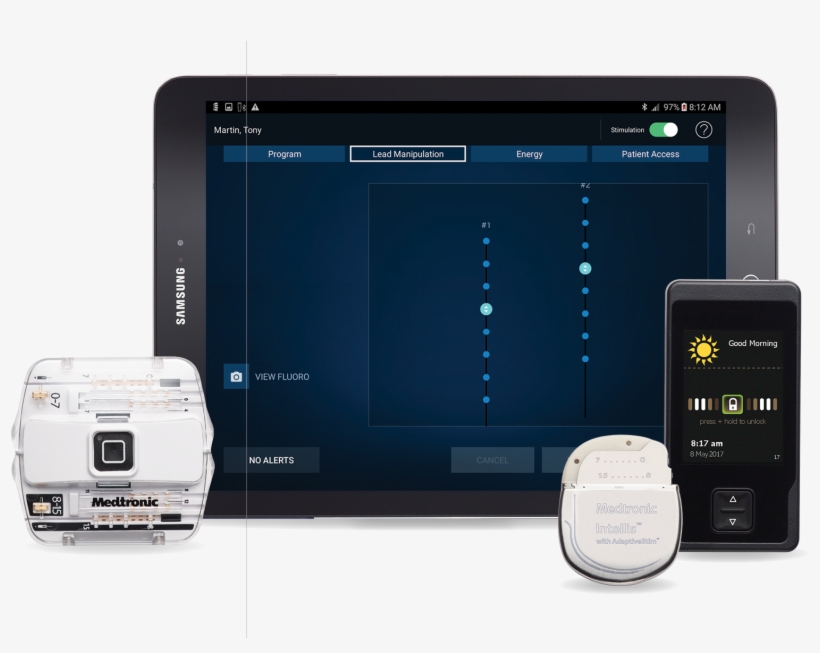 Medtronic Plc Has Announced Fda Approval And Usa Launch - Medtronic Intellis, transparent png #2050342