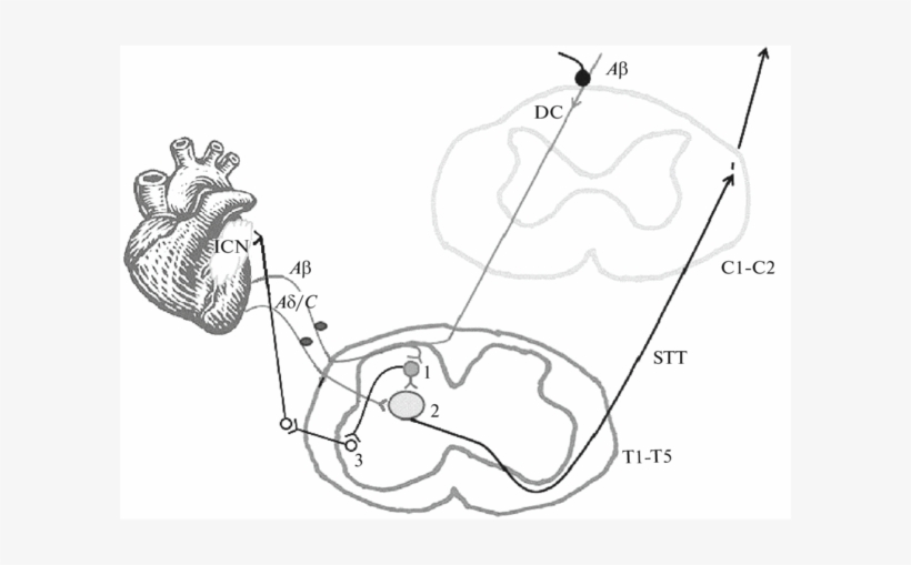 The Scheme Of Effects Of The Spinal Cord Electrical - Spinal Cord, transparent png #2050425