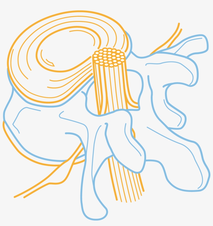 Spinal Cord Injury Centre - Balgrist University Hospital, transparent png #2050524