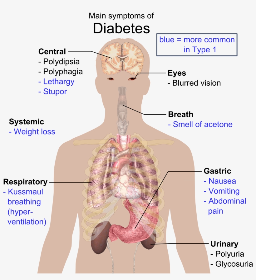 Main Symptoms Of Diabetes, transparent png #2051896