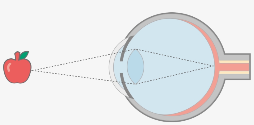 Fig1 In Focus Final - Portable Network Graphics, transparent png #2141783