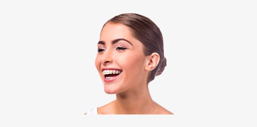Treating Faces, Designing Smiles - Special Offer For Braces, transparent png #2148287