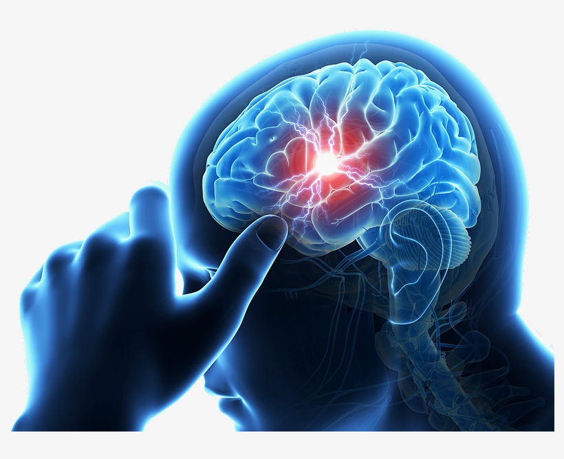 Brain Stroke, transparent png #2149753