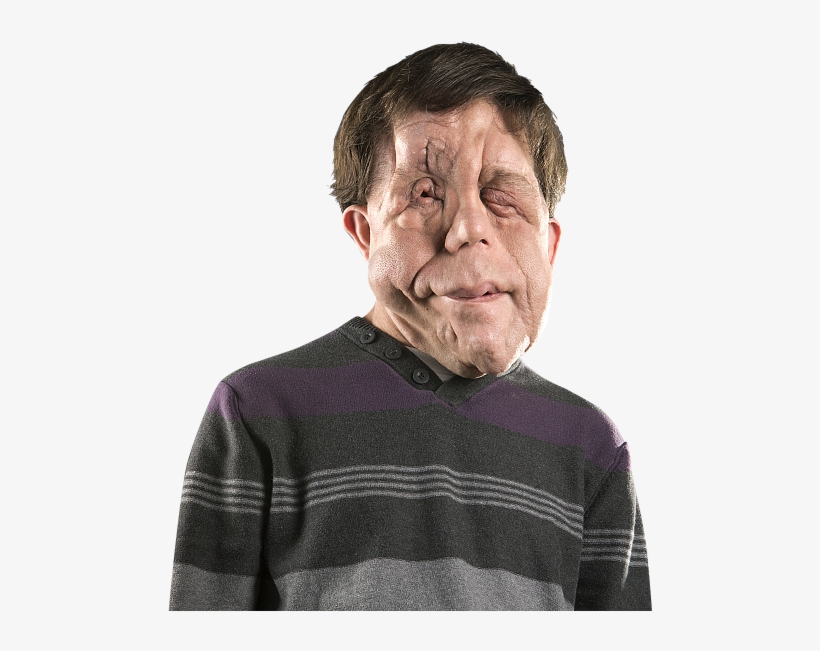 Film Blog Disfigured Heroes Like Deadpool Help People - Adam Pearson, transparent png #2201235