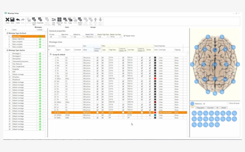 In-home Video Eeg And Ltm Monitoring - Natural Therapies For Parkinson's Disease By Laurie, transparent png #2257877