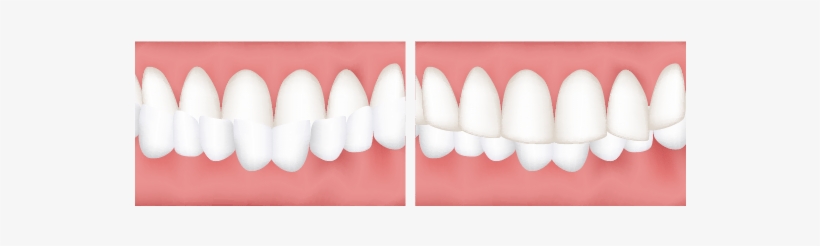 Trembath Dental - Dr Paul Trembath- Dentist, transparent png #2272616