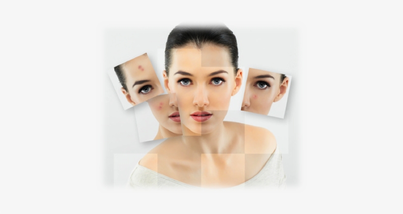 Break Free From Acne - Blackhead And Pimple Remover Kit - Instructions Included, transparent png #2284564