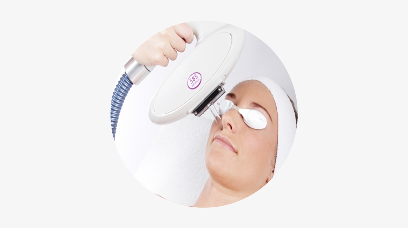 How Does Ipl Treatment Reduce Ance - Circle, transparent png #2284915