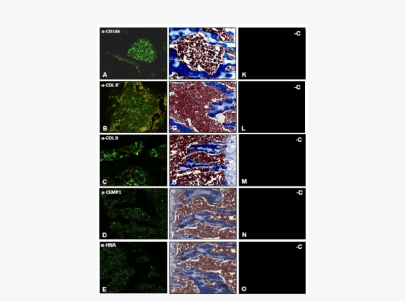 At 14 Days Cells Located In The Vicinity Of Bone And - Tissue, transparent png #234139