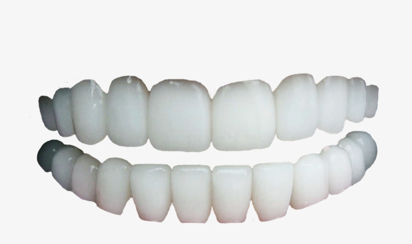 Human Teeth Png Svg Library Download - Human Tooth, transparent png #238403