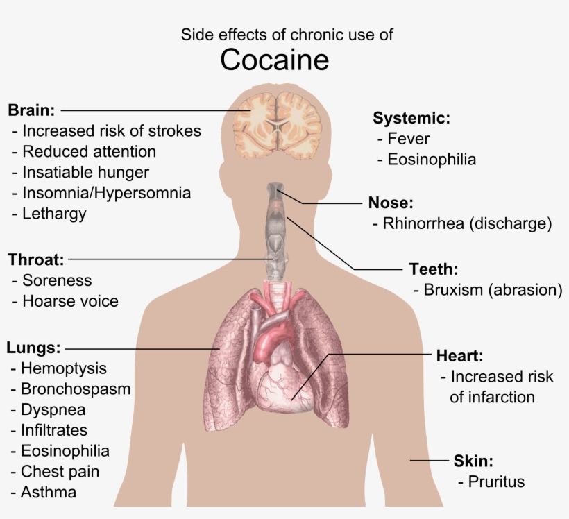 Side Effects Of Chronic Use Of Cocaine - Cocaine Side Effects, transparent png #238801