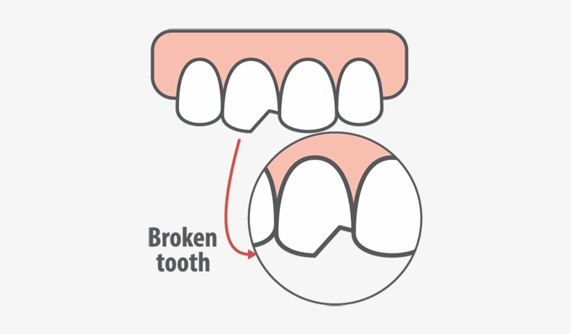 What Is A Dental Emergency, transparent png #2317505