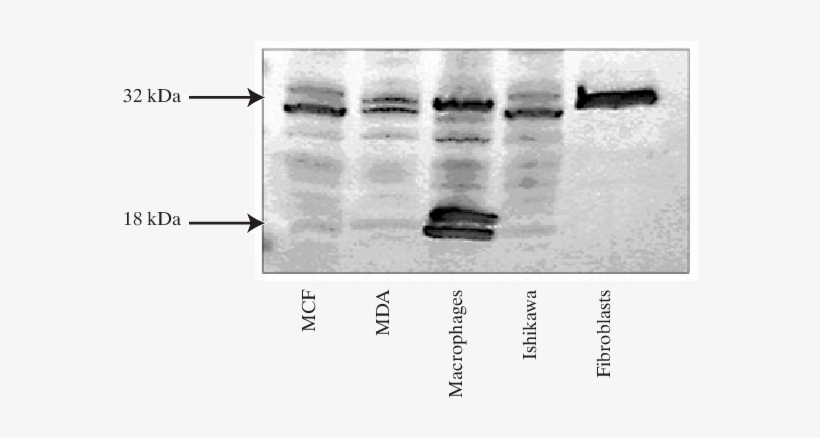 Western Immunoblot Analysis For Pbr In Different Neoplastic - Composite Material, transparent png #2321247