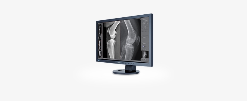 Or Technology's Dicompacs® Diagnostic Software Is Designed - Radiography, transparent png #2323753
