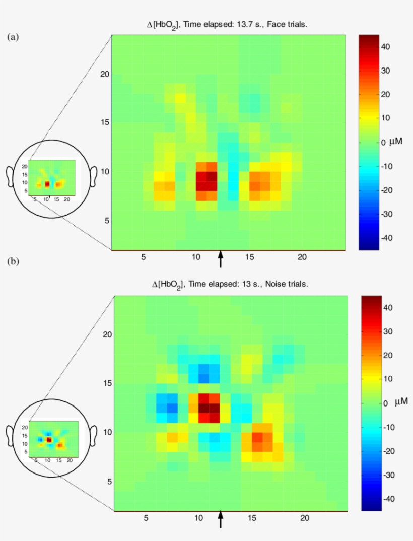 Reconstruction Of Baby A's Optical Topography Data - Diagram, transparent png #2333545