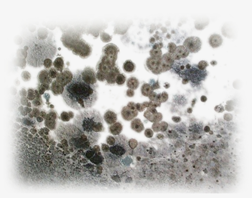 Mold Remediation Services - Does Mold Look Like, transparent png #2337479