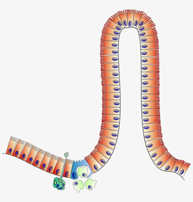 Peyer S Patch - Peyer's Patches Clipart, transparent png #2351241