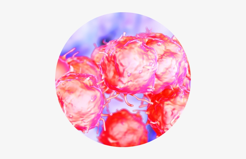 Mesenchymal Stem Cells - Non Hodgkin's Lymphoma Cells, transparent png #2351511