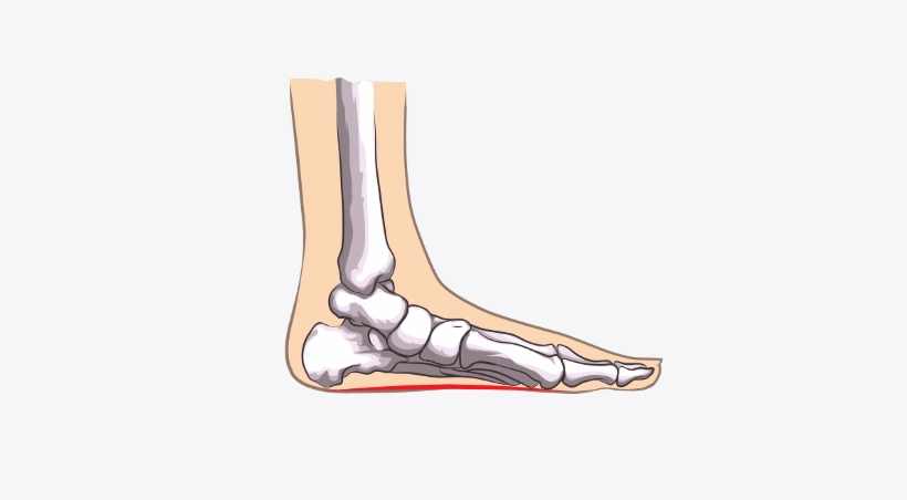 My Program Made Use Of This Old-school Wisdon, Combined - Straight Feet Problem, transparent png #2374185