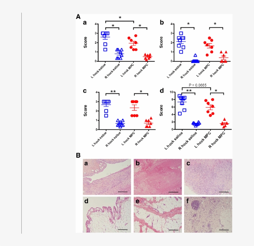 A Effect Of Mpc Treatment On Synovial Histopathology - Joint, transparent png #2380228