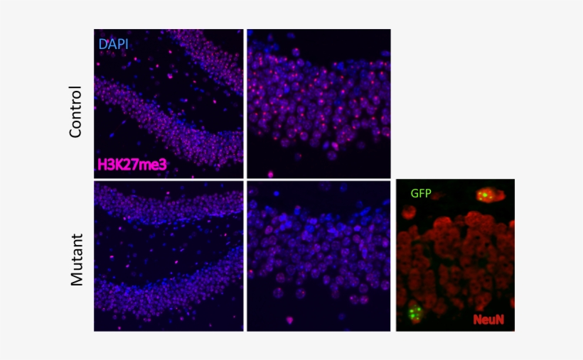 Methylation Status And Mecp2-gfp Reactivation Are Shown - Xist, transparent png #2383209