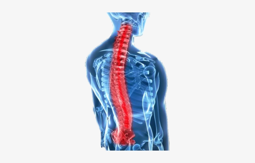 Kuala Lumpur Spine - Whiplash: Evidence Base For Clinical Practice, transparent png #2383327