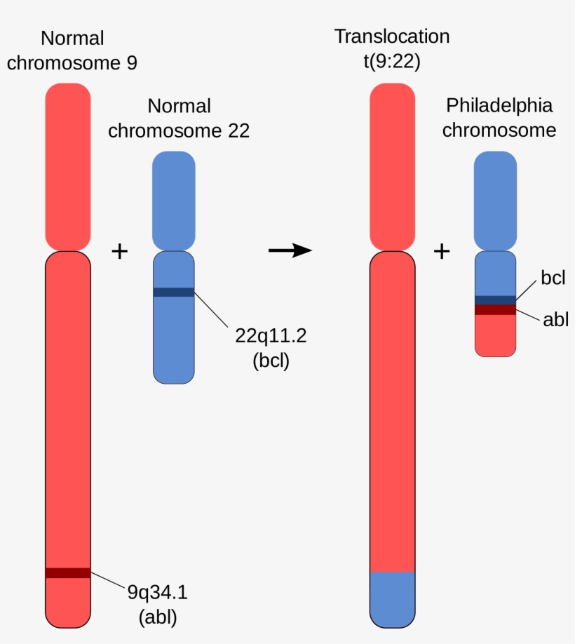 Open - Philadelphia Chromosome, transparent png #2383487