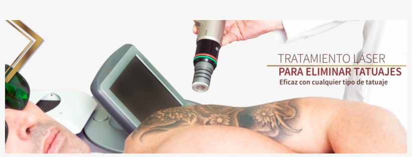 Elimina Esos Tatuajes No Deseados - Writing, transparent png #2386568