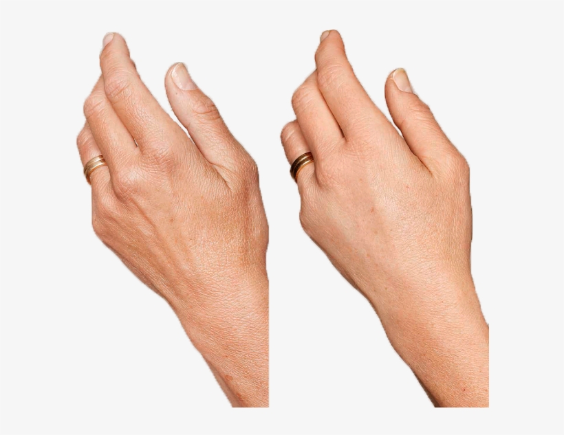 Collage Manos Def - Human, transparent png #2400265