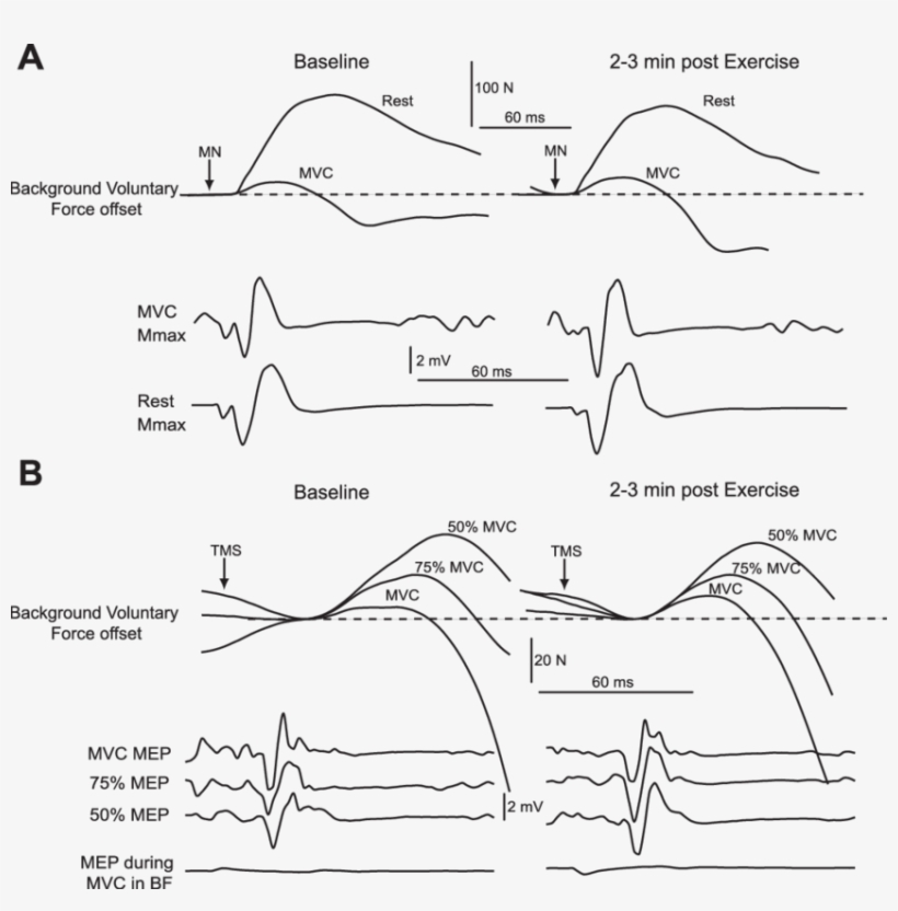 Raw Traces Of Twitch Forces And Electromyographic Responses - Force, transparent png #2424072