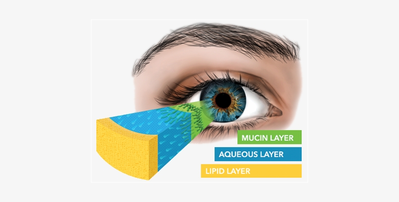 Understanding The Tear Film And Dry Eye - Dry Eye, transparent png #2487123
