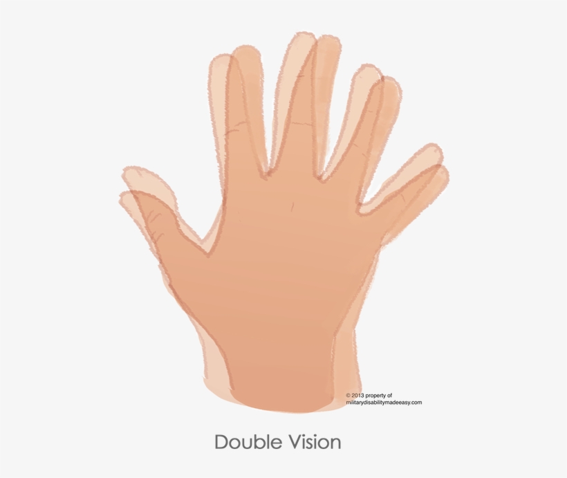 Ds Store - Cartoon Cuts And Bruises, transparent png #2524039