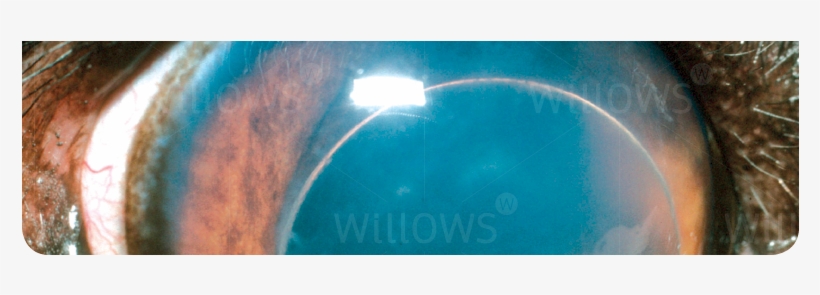 Lens Luxation - Cat, transparent png #2525826