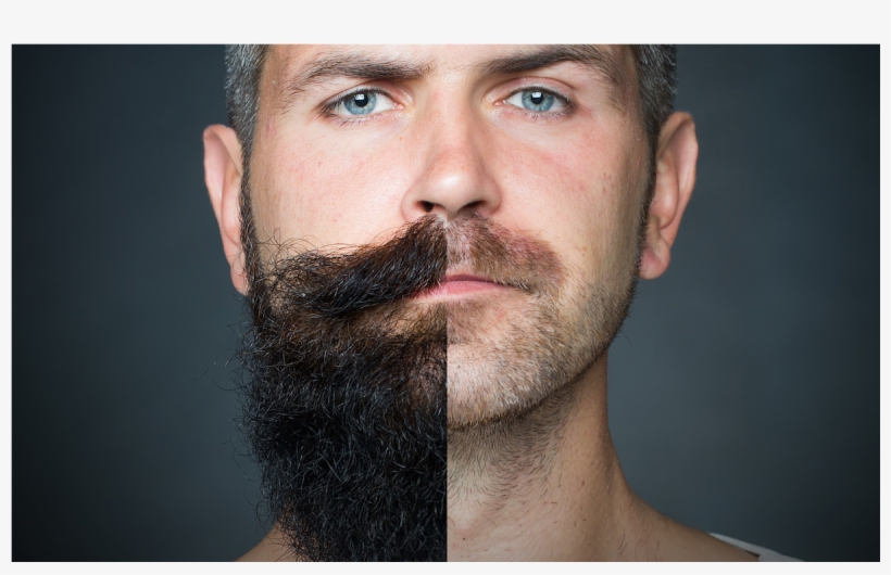 Real Facial Hair Png Download - Beard Grow Xl | Facial Hair Supplement | #1 Mens Hair, transparent png #2532442
