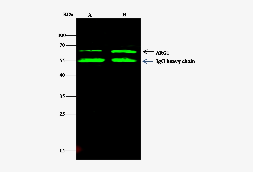 Schistosoma Japonicum Glutathione S-transferase/gst - Mapk14, transparent png #2541607