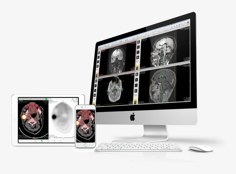 Devices-osirix - Opal Tech Solutions, transparent png #2588658