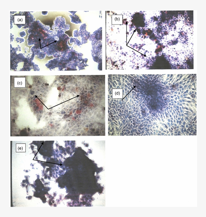 Kb Cells Were Cultured In Dmem-10% Fcs Medium For 5 - Visual Arts, transparent png #264562