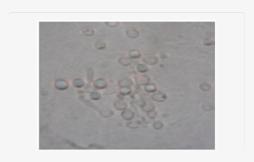 Showing Conjugation Tubes In E - Drop, transparent png #2621909