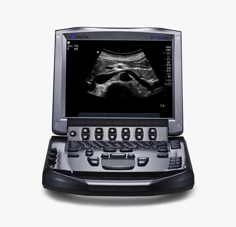 Sonosite M-turbo® Ultrasound System - M Turbo, transparent png #2649095