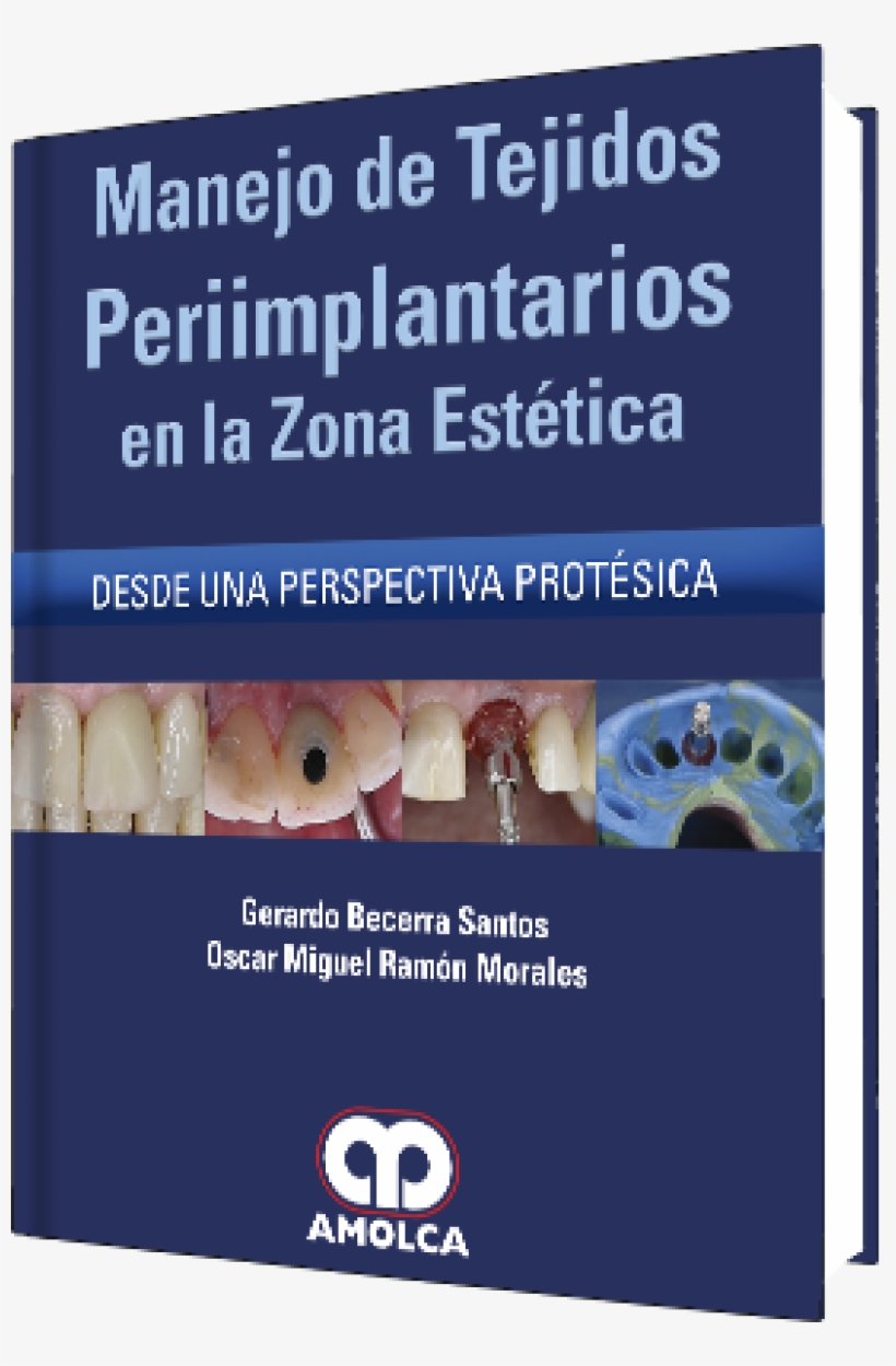 Manejo Tejidos Periimplantarios En Zona Estetica - Surgery, transparent png #2654052
