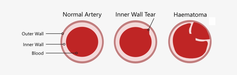 What Is Scad - Circle, transparent png #2680407