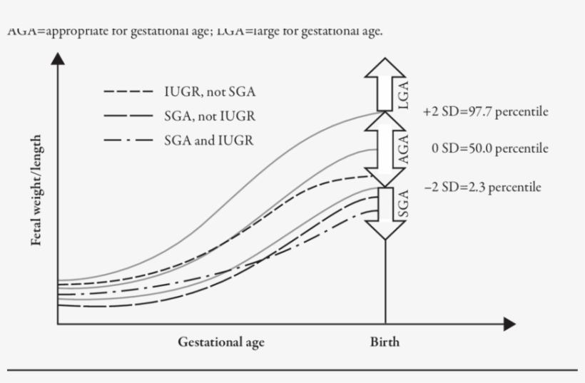 Sga Chart